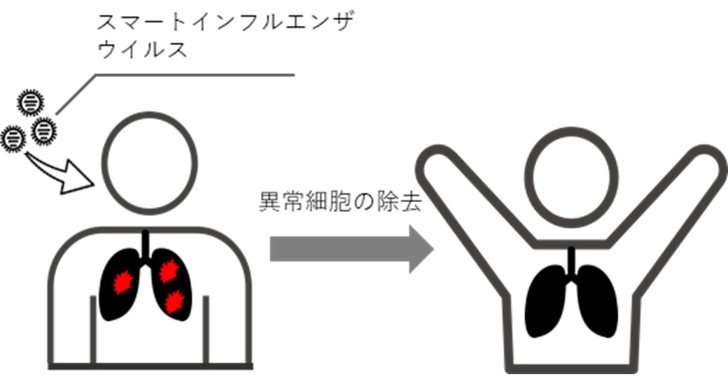 スマートインフルエンザウイルスを用いた肺疾患のウイルス療法