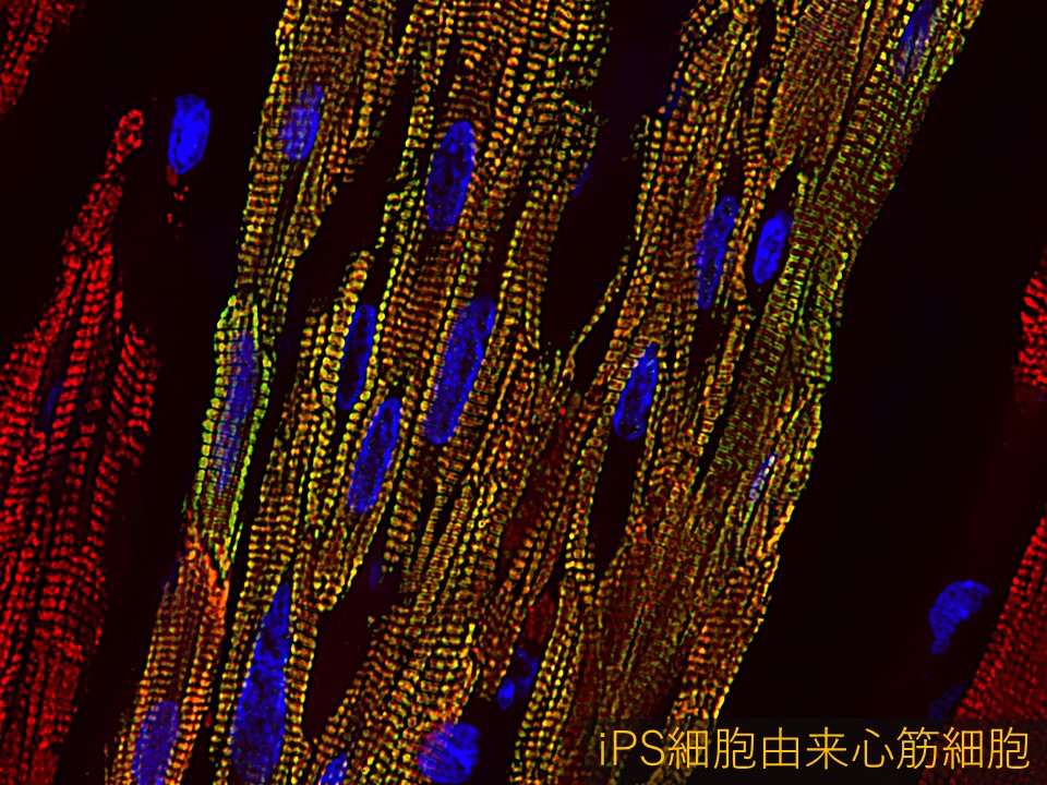 自家細胞を用いた心筋再生治療の実用化開発