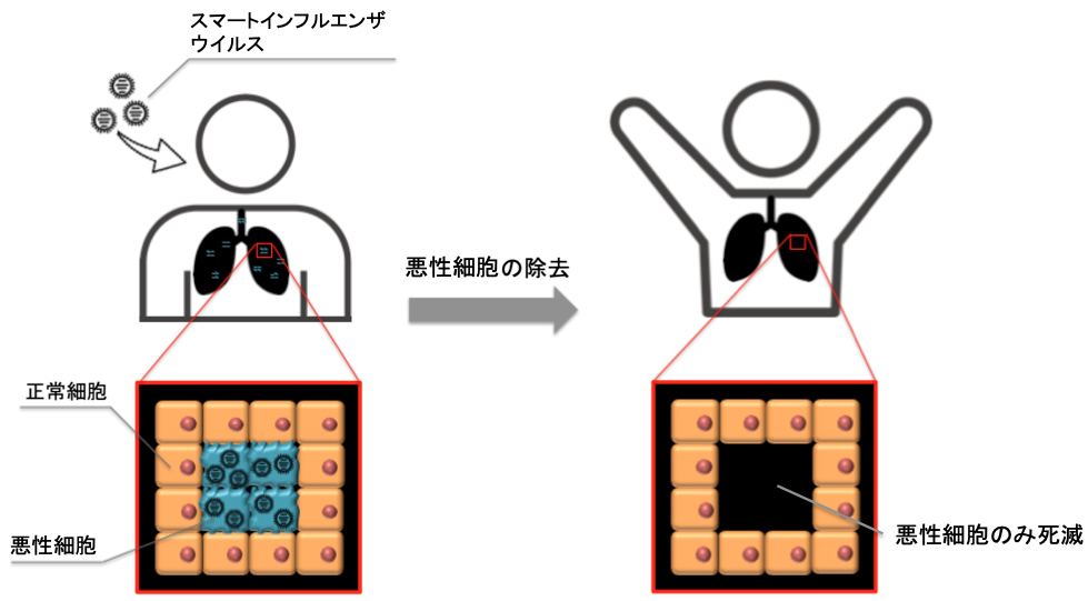 スマートインフルエンザウイルスを用いた肺疾患のウイルス療法
